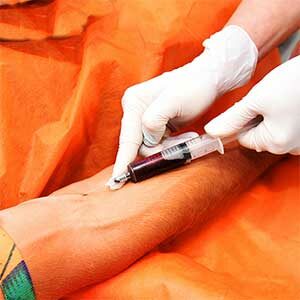 Blutabnahme Vorbereitung Mesotherapie